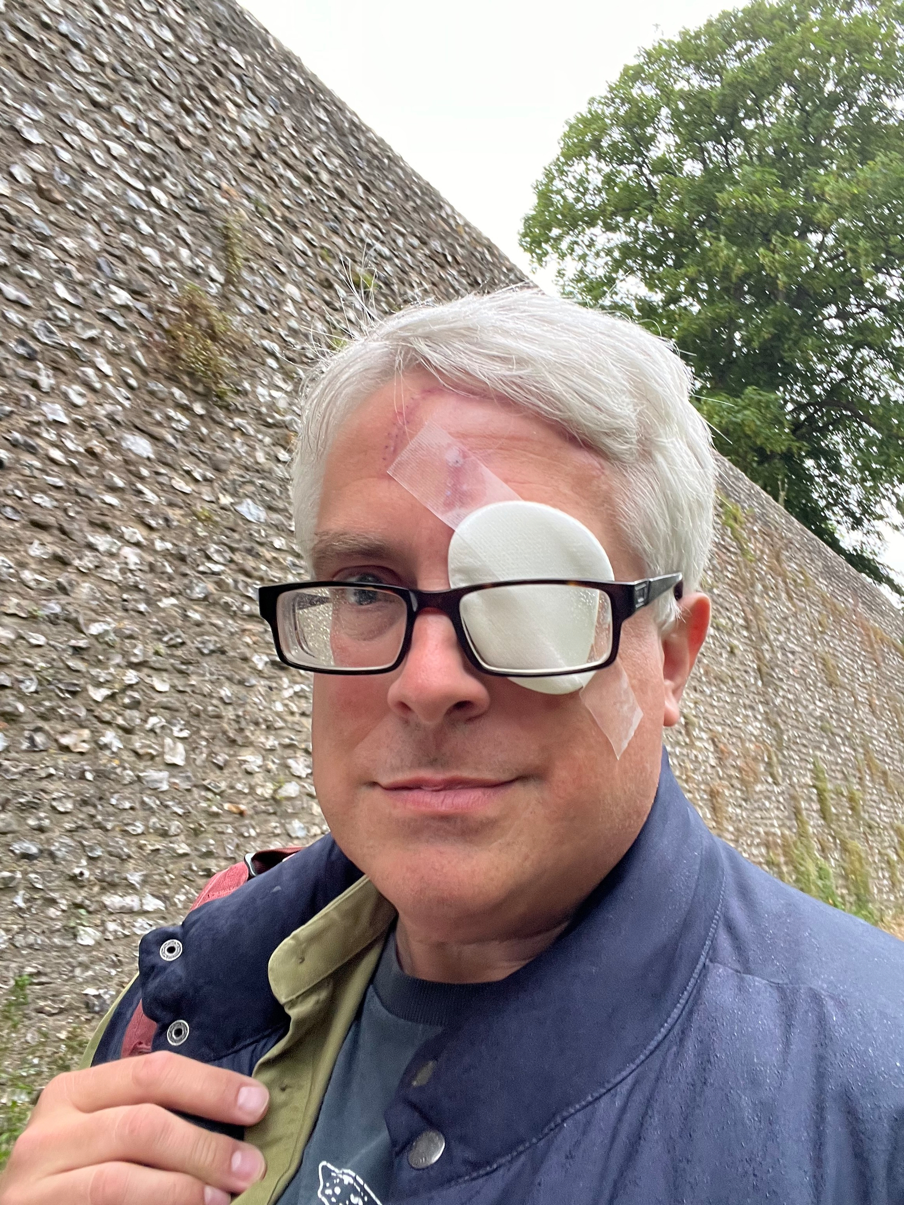 A person with gray hair is wearing glasses and an eyepatch while standing outdoors near a textured wall and trees.